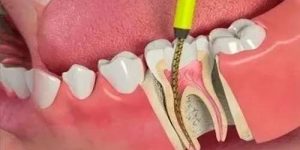 Emergência Dental