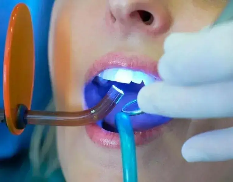 Mitos e Verdades Sobre o Clareamento Dental