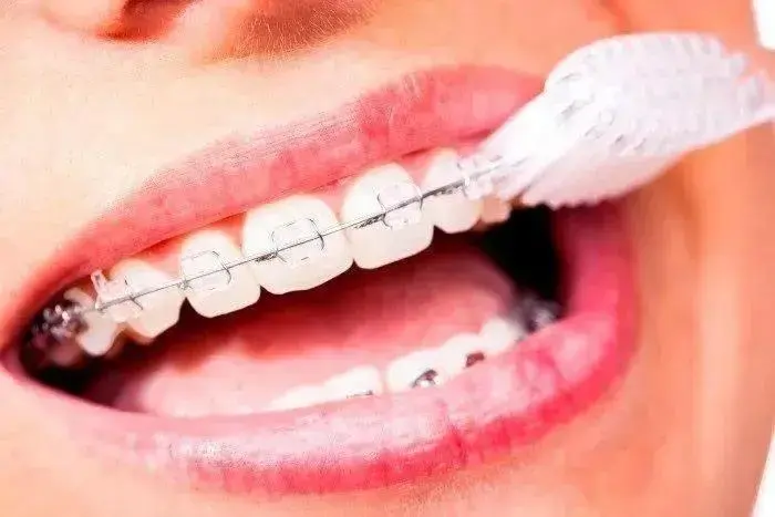 O Processo de Adaptação ao Novo Aparelho Dental