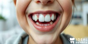 5 Curiosidades sobre os Dentes de Leite e sua Transição para os Dentes Adultos