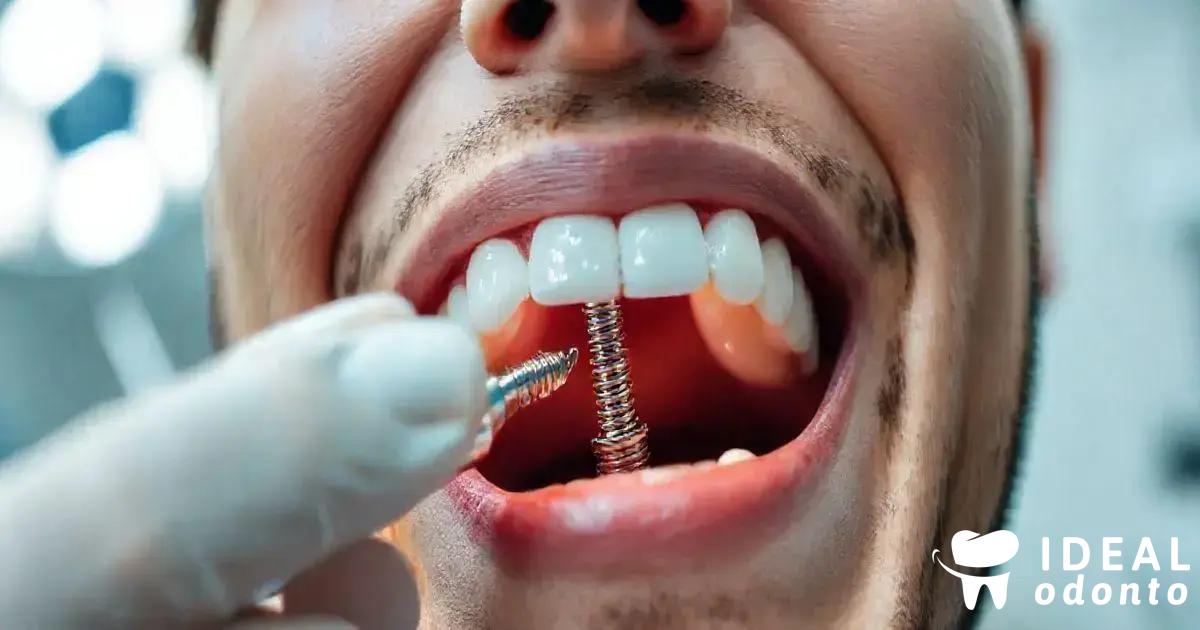 E quanto às contraindicações para o implante dentário?